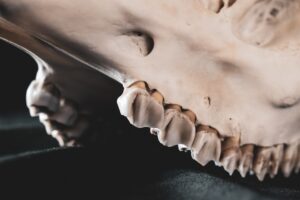 découvrez l'échelle de la douleur : un outil essentiel pour évaluer et mieux gérer la douleur. apprenez comment elle fonctionne et son importance dans le suivi médical.